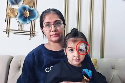 मेरठ: आँख के पास घाव पर चिपका दिया 5 रुपये का फेवीक्विक!