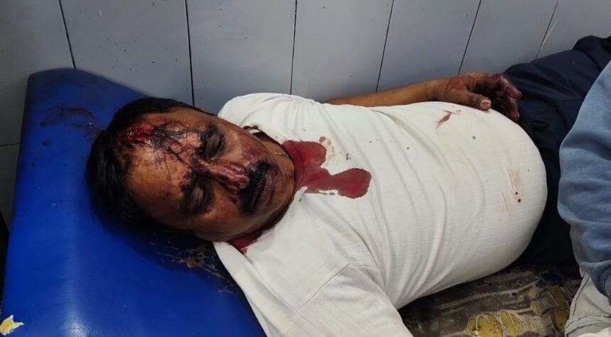 घायलों की स्थिति गंभीर
