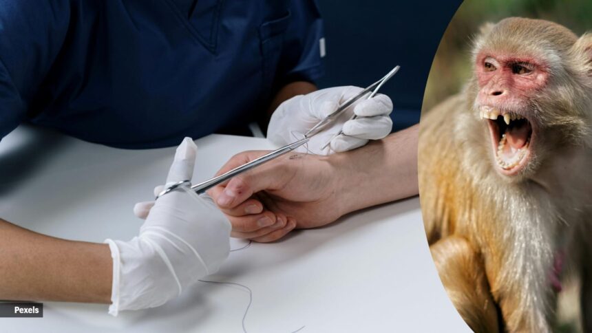 मोदी चीनी मिल में बंदरों का आंतक, गार्ड का जबड़ा नों