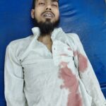 सलीम वास्तिक हमला